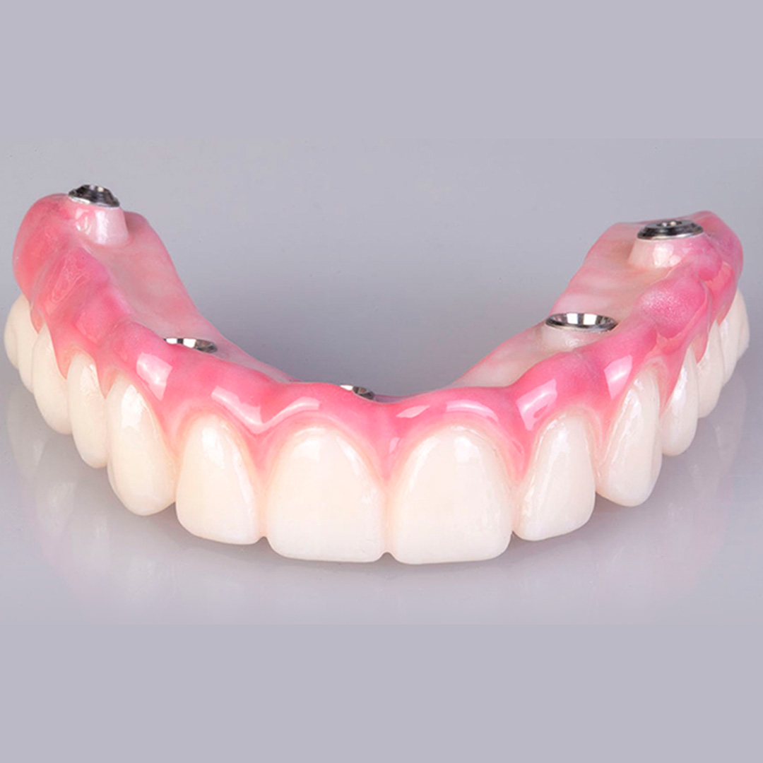 Protocolo dentário e All-on-4 em Juiz de Fora